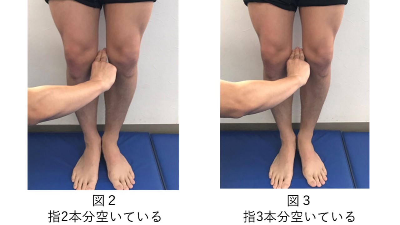 膝の痛みとｏ脚の関係について わしざわ整形外科 新着ニュース